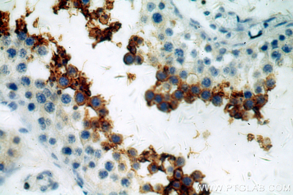 IHC staining of human testis using 20828-1-AP