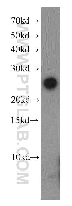 WB analysis of human testis using 20828-1-AP