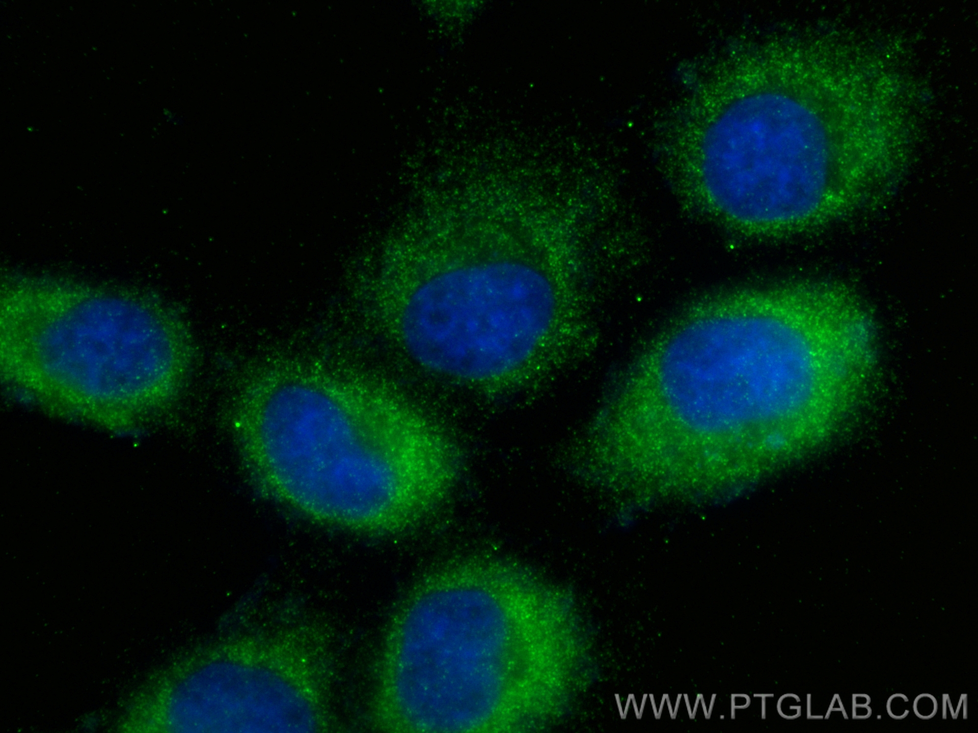 IF Staining of A431 using 16508-1-AP