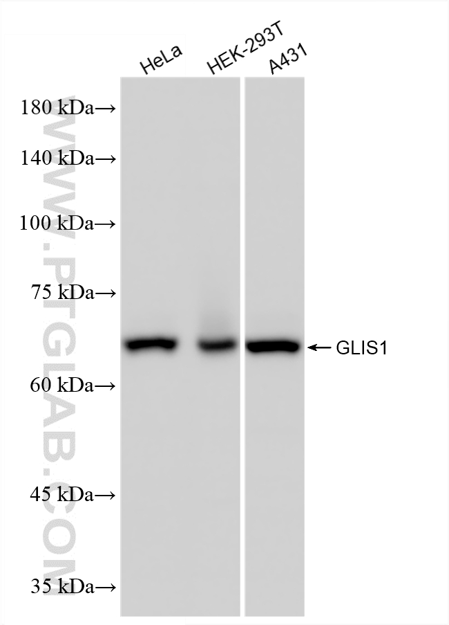 WB analysis using 86902-1-RR (same clone as 86902-1-PBS)