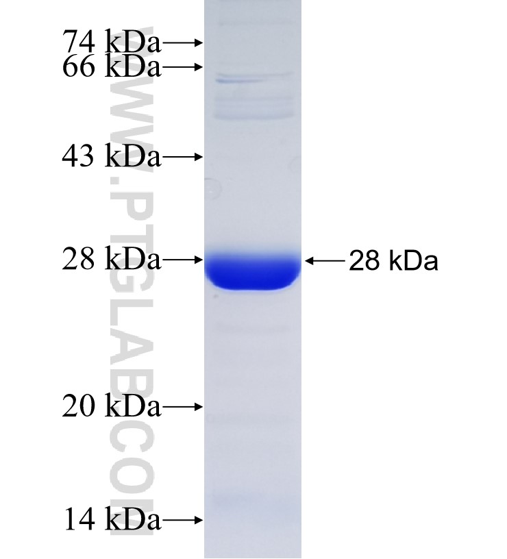 GLIS2 fusion protein Ag33852 SDS-PAGE GLIS2 fusion protein Ag33852 SDS-PAGE