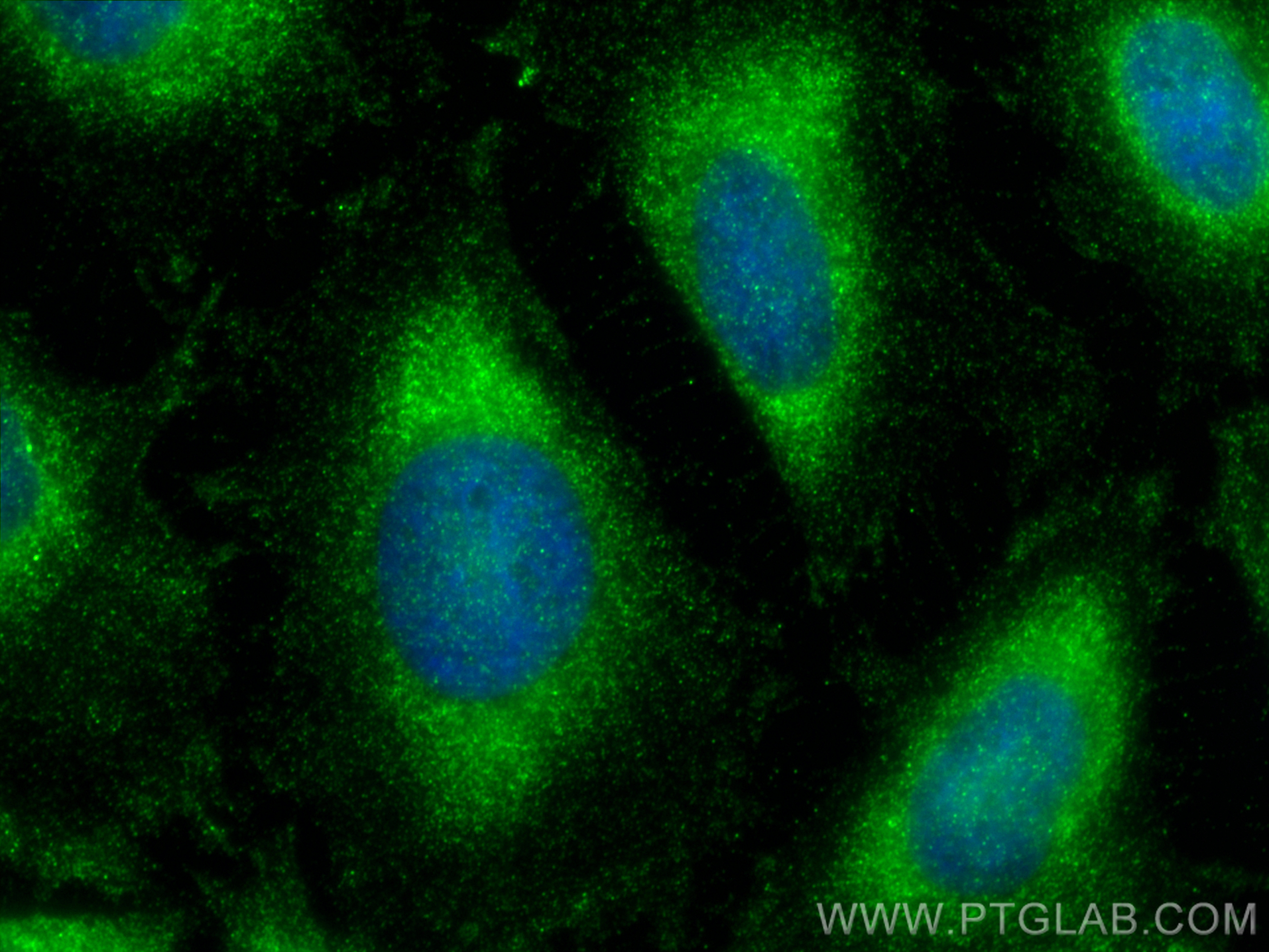 IF Staining of HeLa using 32645-1-AP (same clone as 32645-1-PBS) IF Staining of HeLa using 32645-1-AP (same clone as 32645-1-PBS)
