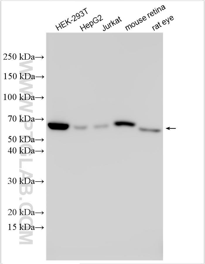 WB analysis using 32645-1-AP (same clone as 32645-1-PBS) WB analysis using 32645-1-AP (same clone as 32645-1-PBS)
