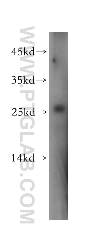 WB analysis of HeLa using 18477-1-AP