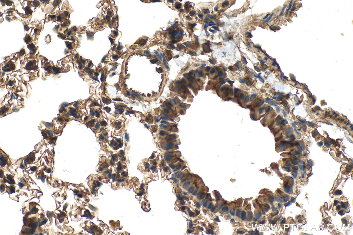 IHC staining of mouse lung using 26196-1-AP