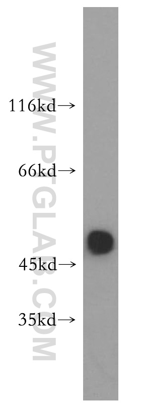 WB analysis of mouse brain using 17951-1-AP