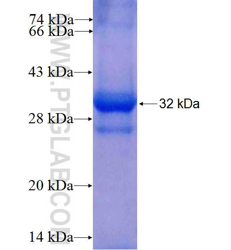 GLRA2 fusion protein Ag4895 SDS-PAGE GLRA2 fusion protein Ag4895 SDS-PAGE