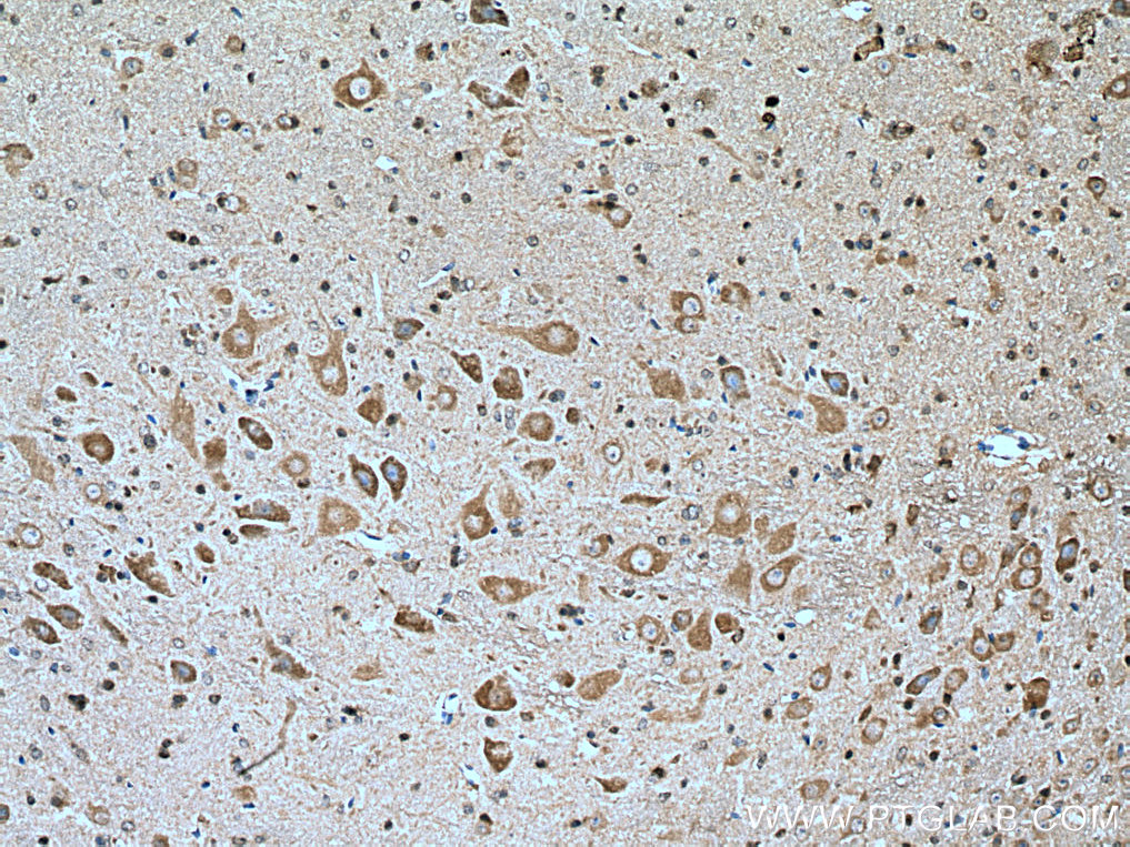 IHC staining of mouse cerebellum using 15371-1-AP