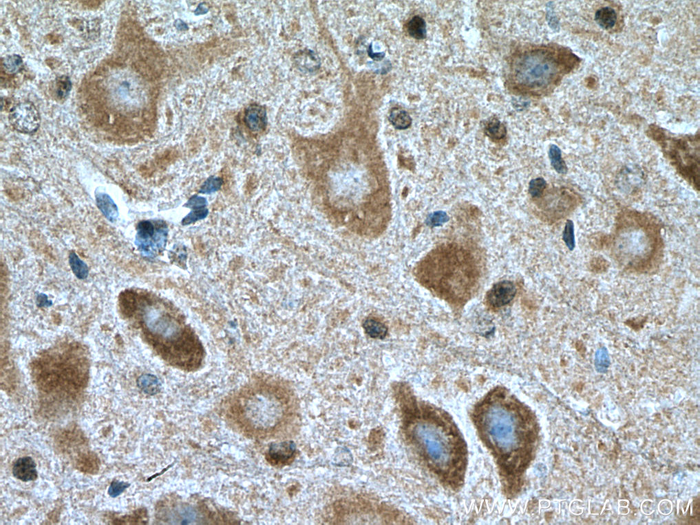 IHC staining of mouse cerebellum using 15371-1-AP