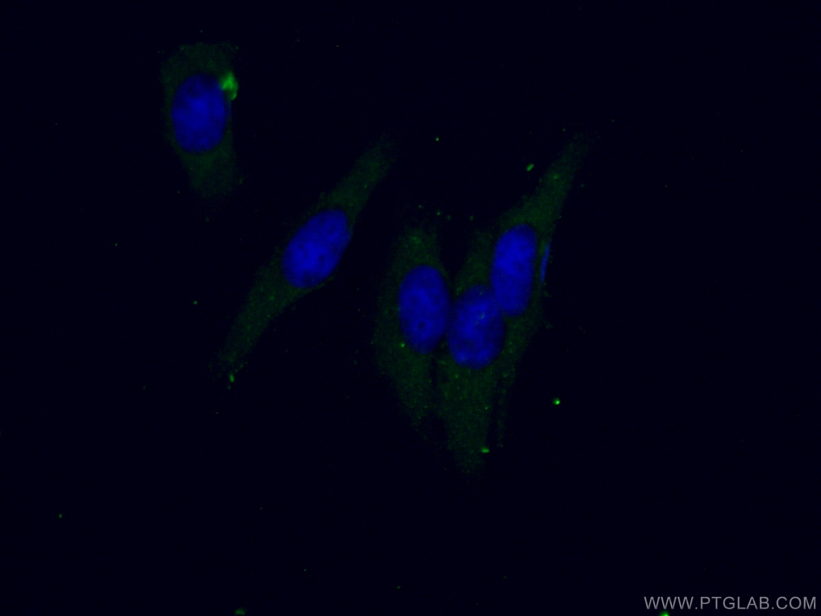 IF Staining of HepG2 using 15804-1-AP