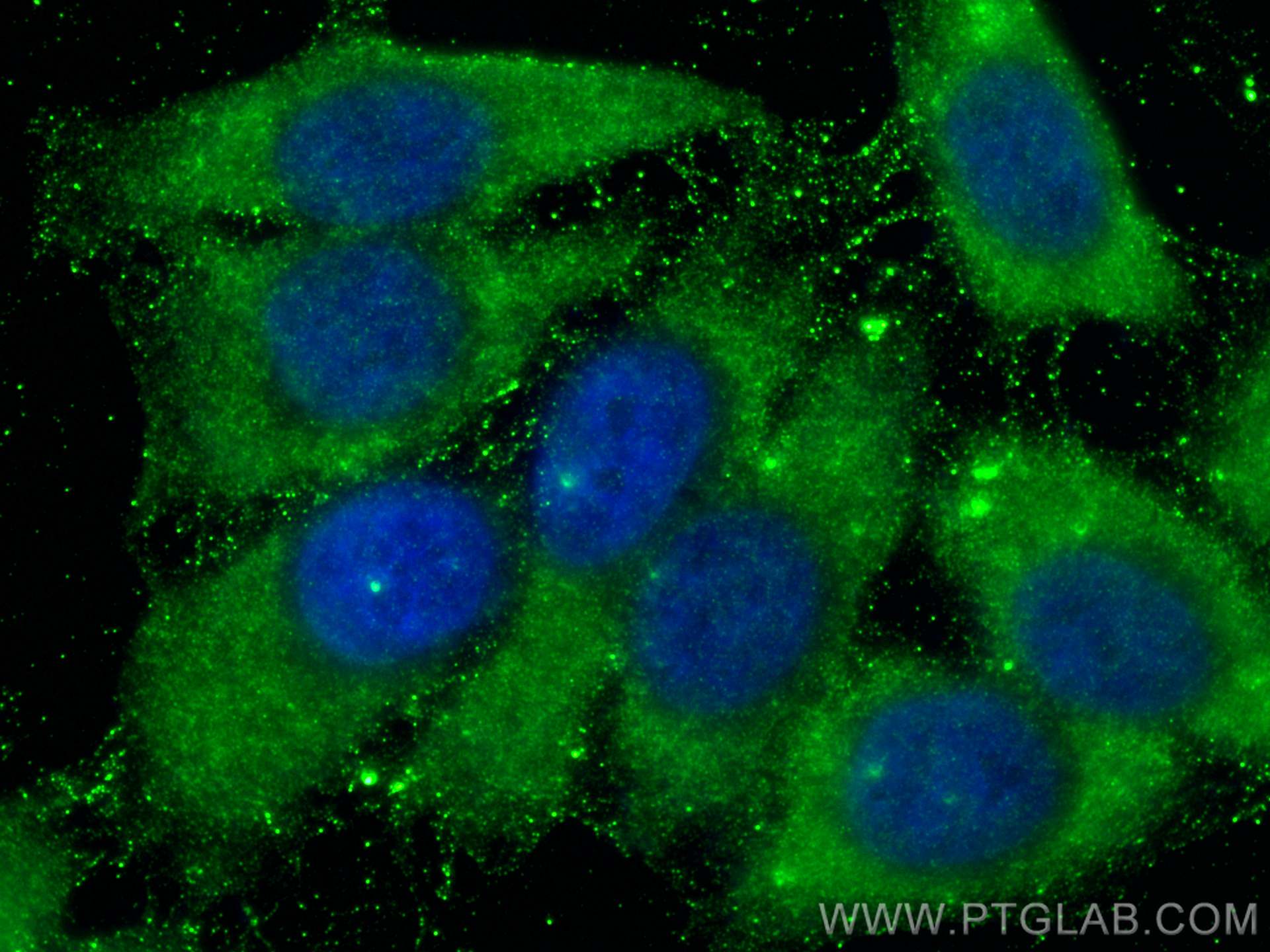 IF Staining of HepG2 using 15804-1-AP