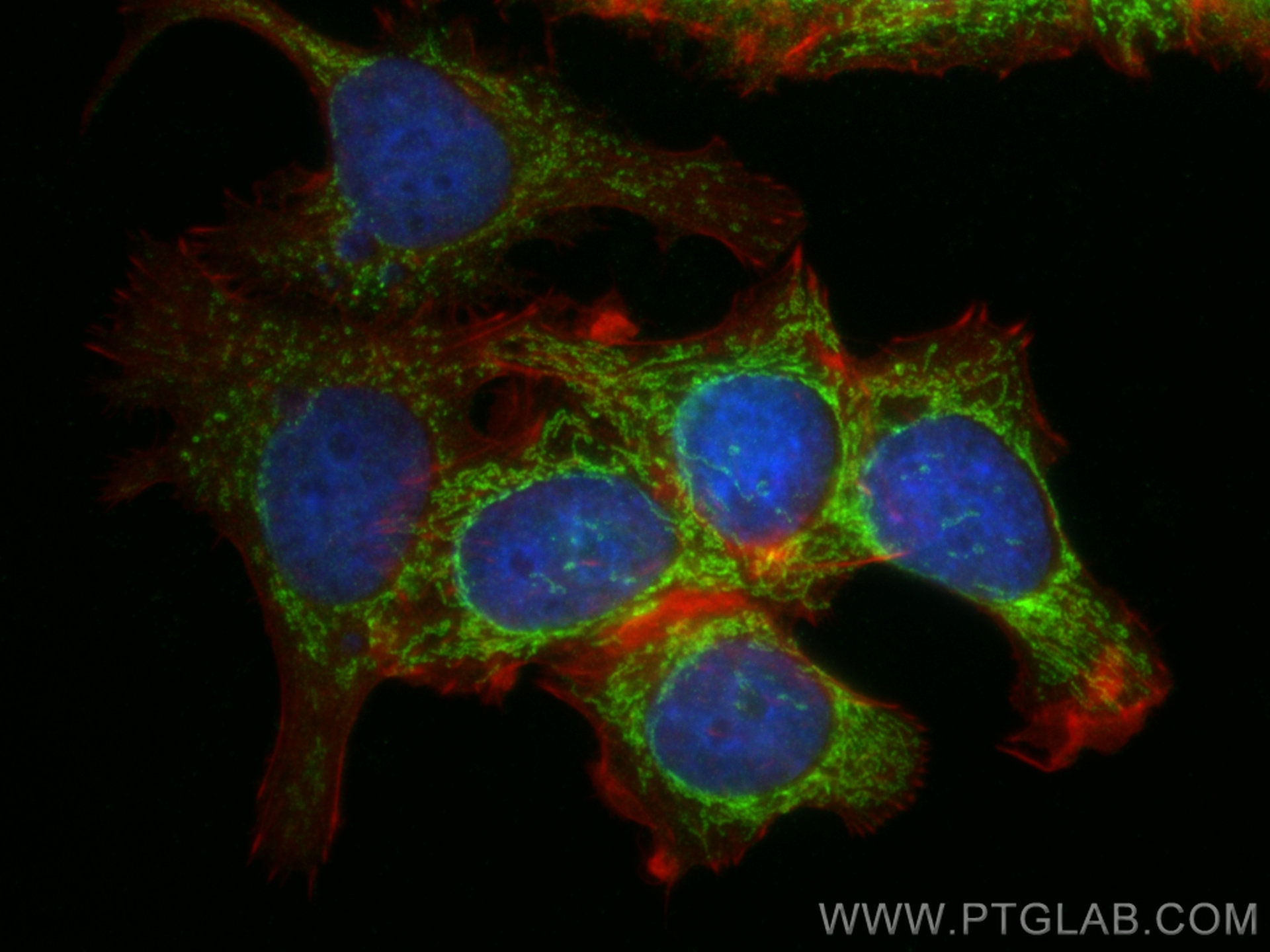 IF Staining of MCF-7 using 18884-1-AP (same clone as 18884-1-PBS)