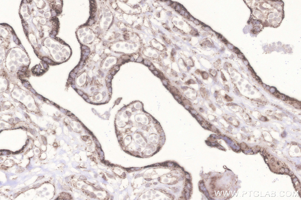 IHC staining of human placenta using 18884-1-AP