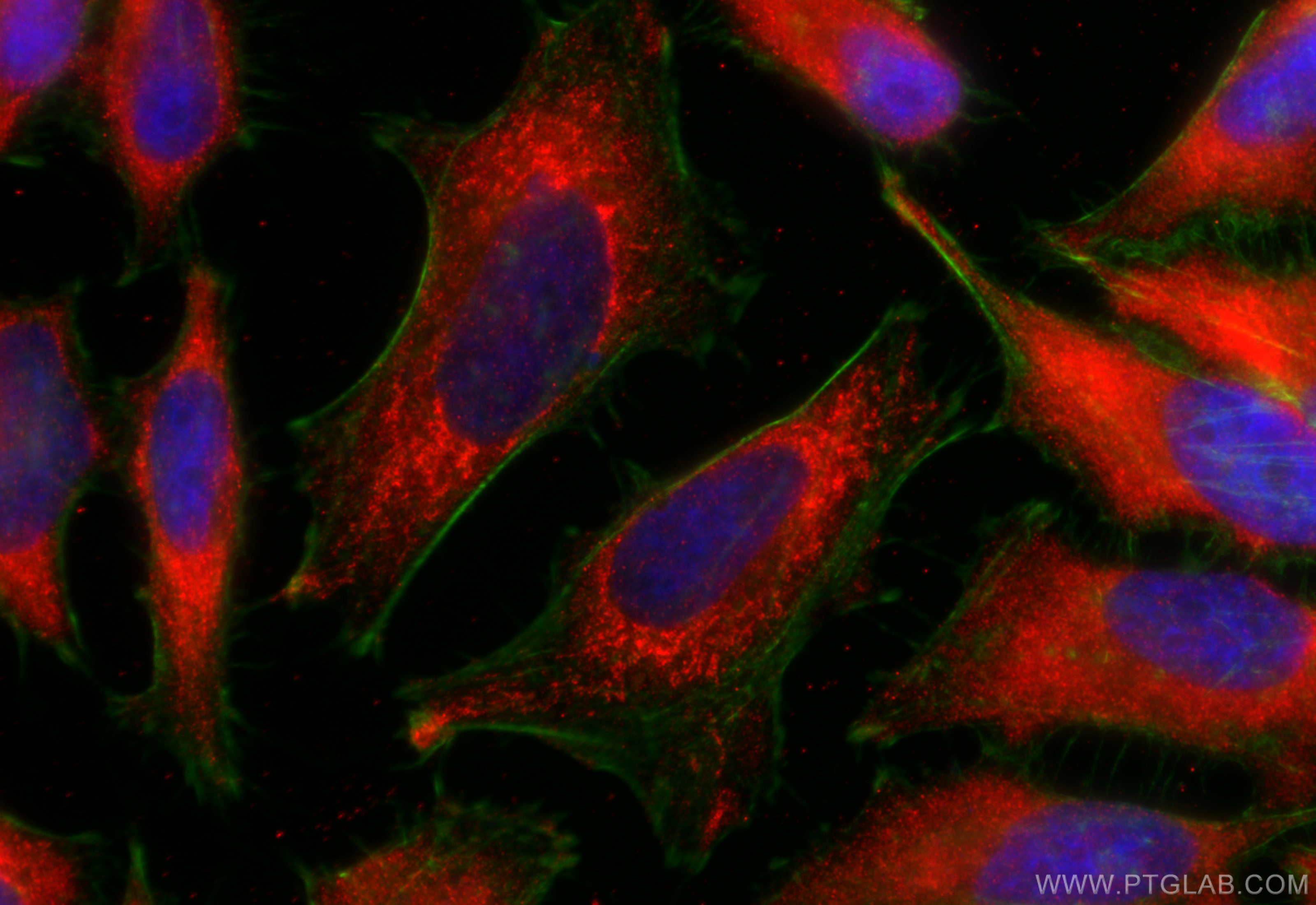 IF Staining of hela using 20170-1-AP