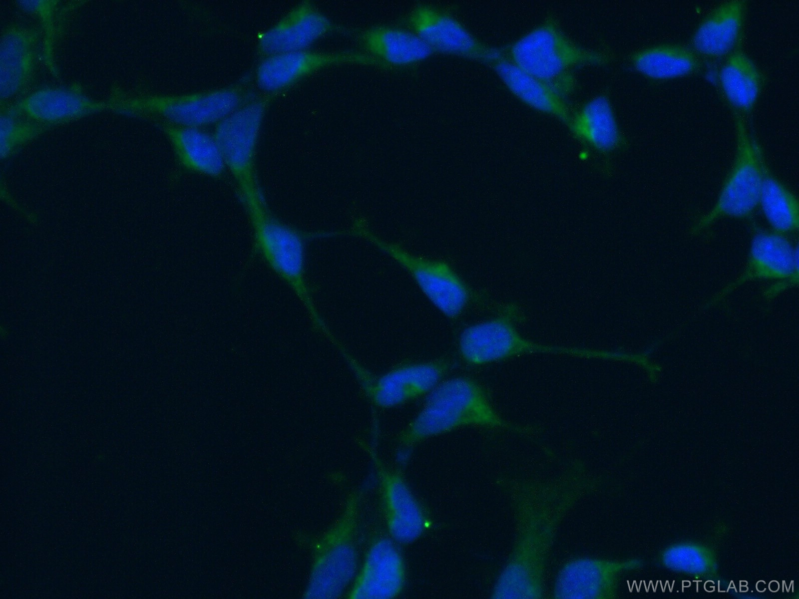 IF Staining of HEK-293 using 20170-1-AP