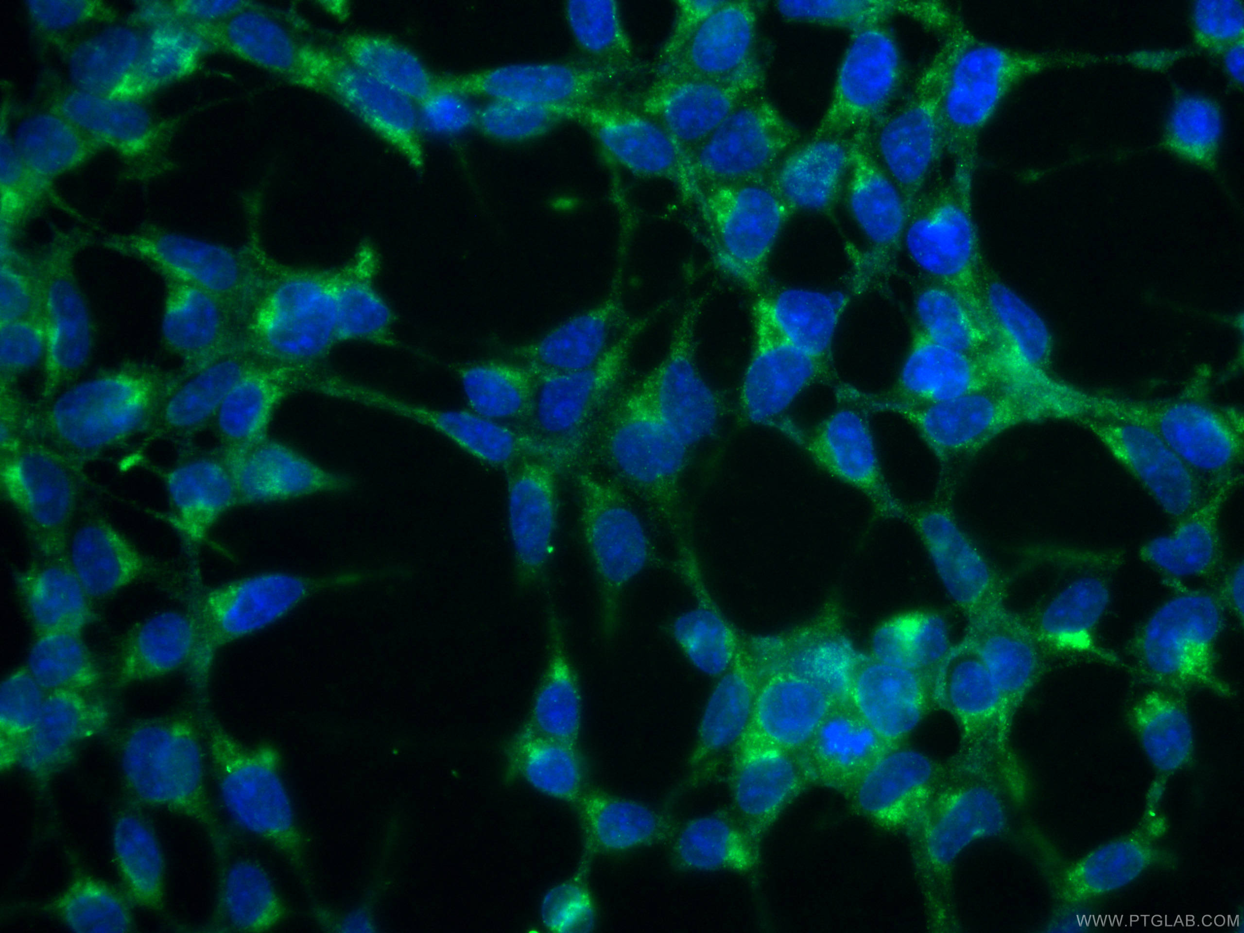 IF Staining of HEK-293 using 23549-1-AP