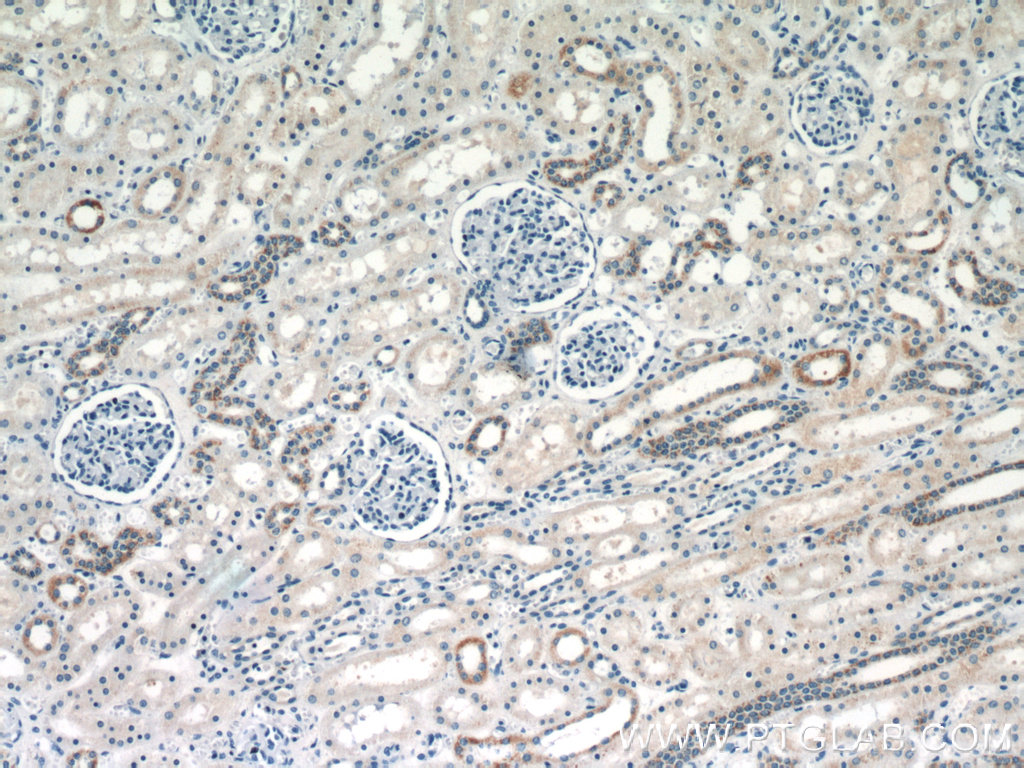 IHC staining of human kidney using 23549-1-AP