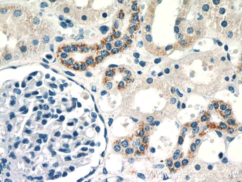 IHC staining of human kidney using 23549-1-AP