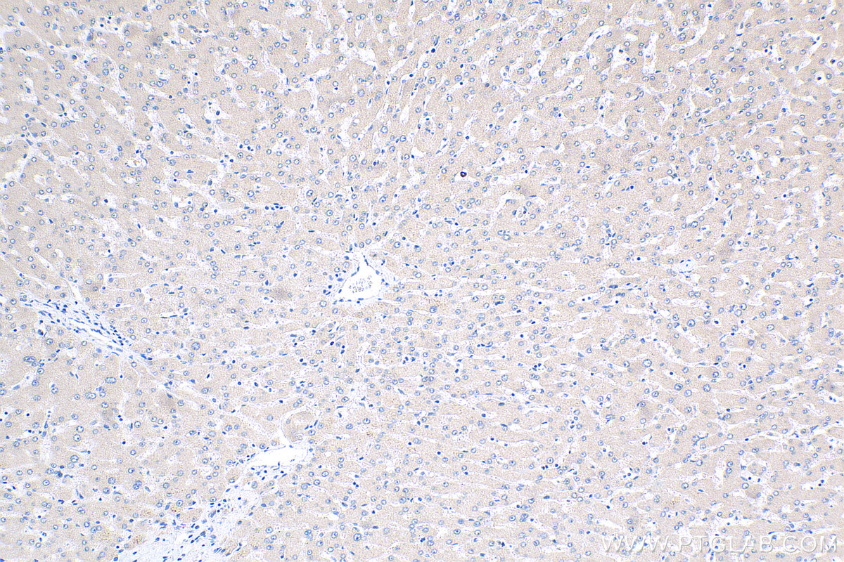 IHC staining of human liver using 20171-1-AP