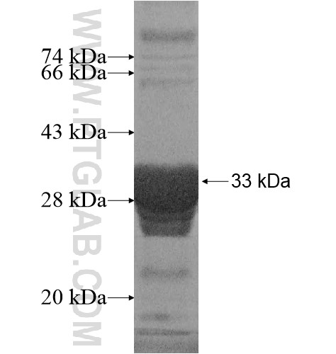 GLS2 fusion protein Ag14003 SDS-PAGE