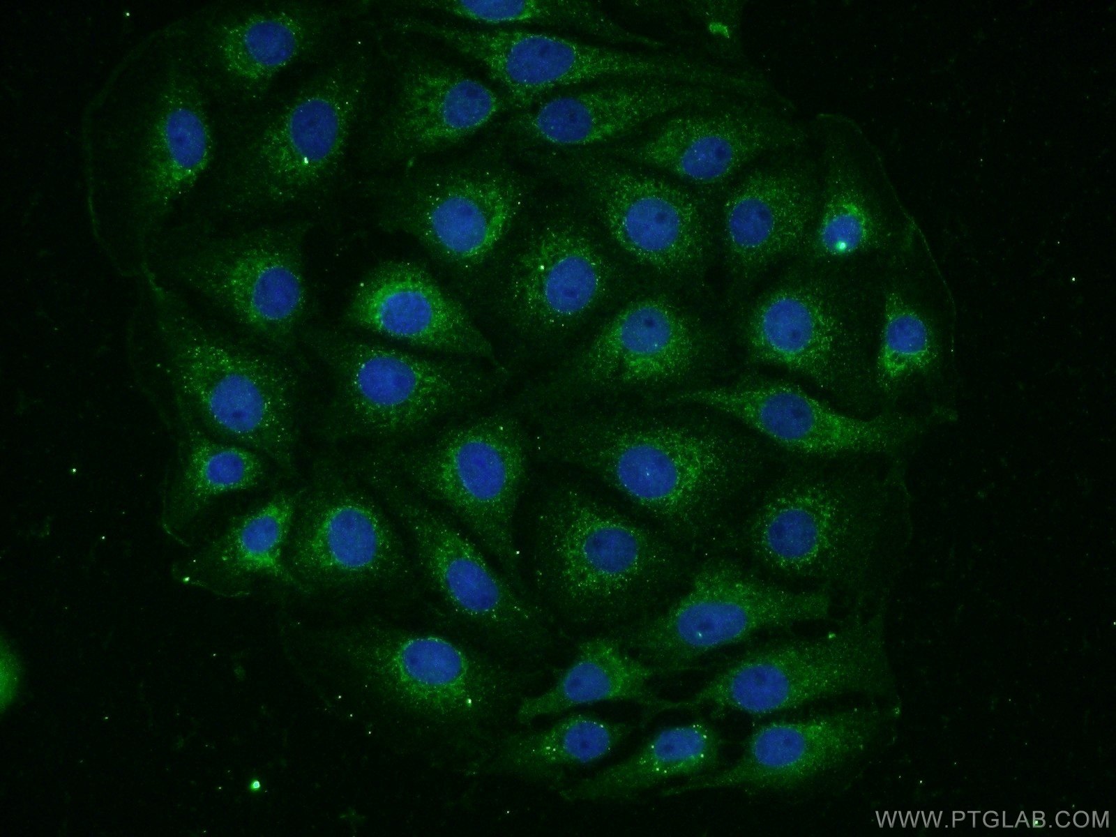 IF Staining of SH-SY5Y using 16768-1-AP