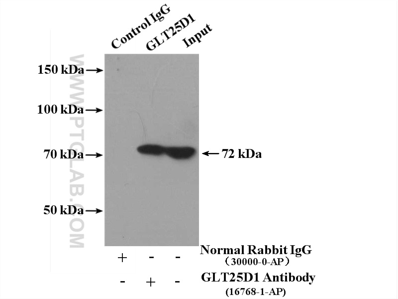 IP experiment of HeLa using 16768-1-AP