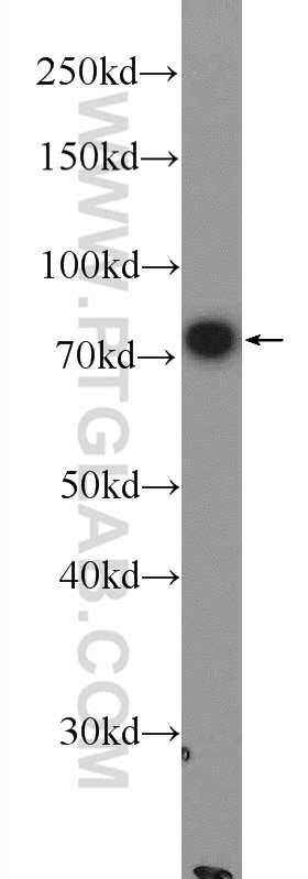 WB analysis of HeLa using 16768-1-AP