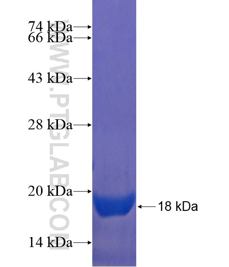 GLT8D1 fusion protein Ag21799 SDS-PAGE GLT8D1 fusion protein Ag21799 SDS-PAGE