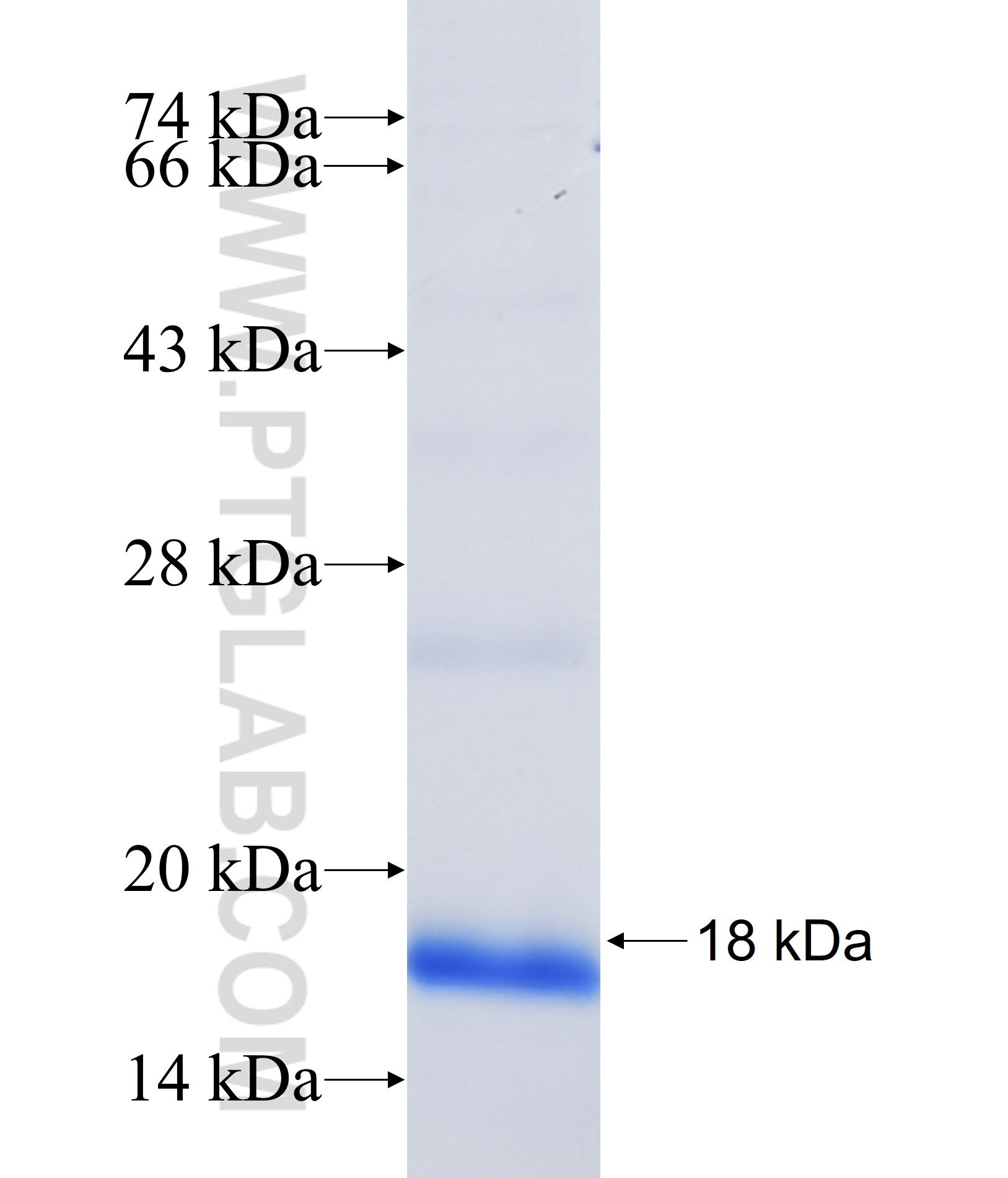 GLTPD2 fusion protein Ag41338 SDS-PAGE GLTPD2 fusion protein Ag41338 SDS-PAGE