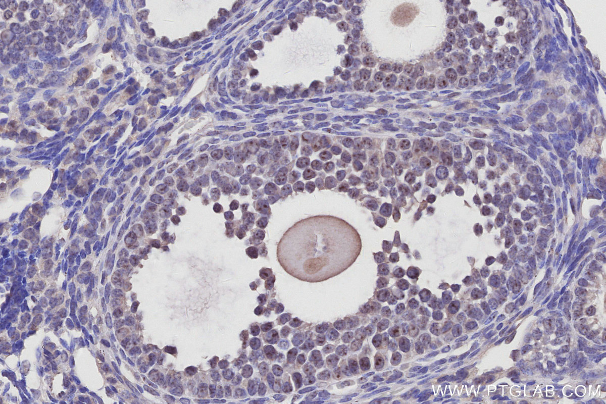IHC staining of mouse ovary using 27353-1-AP IHC staining of mouse ovary using 27353-1-AP