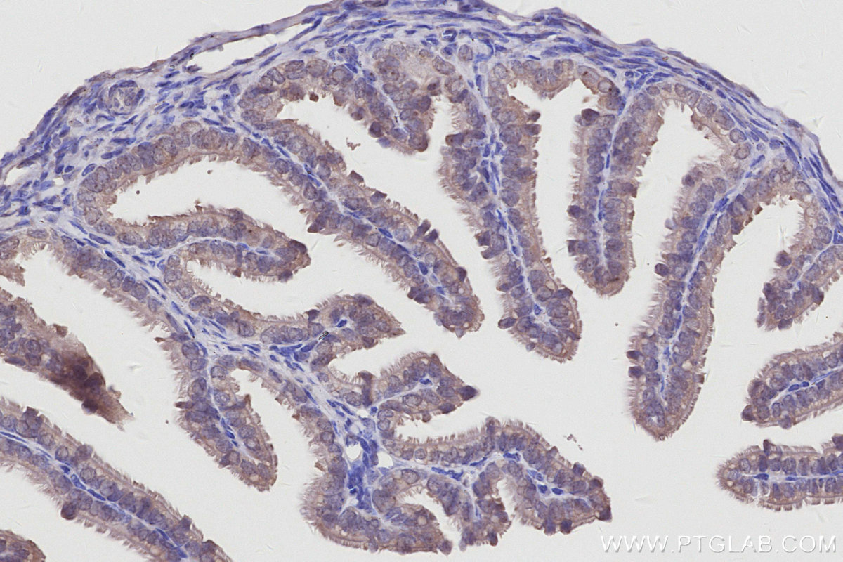 IHC staining of mouse ovary using 27353-1-AP IHC staining of mouse ovary using 27353-1-AP