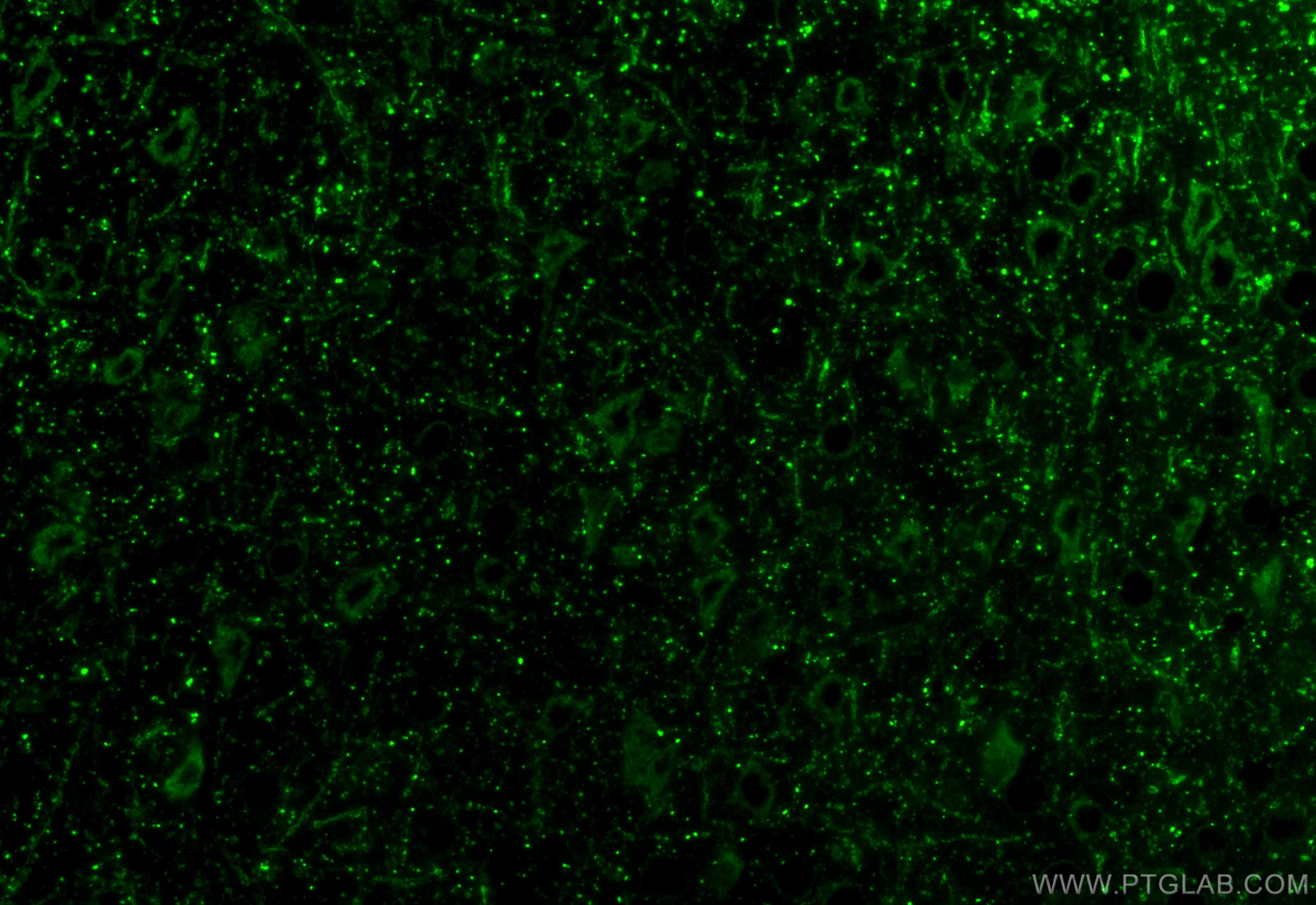 IF Staining of mouse brain using 14299-1-AP