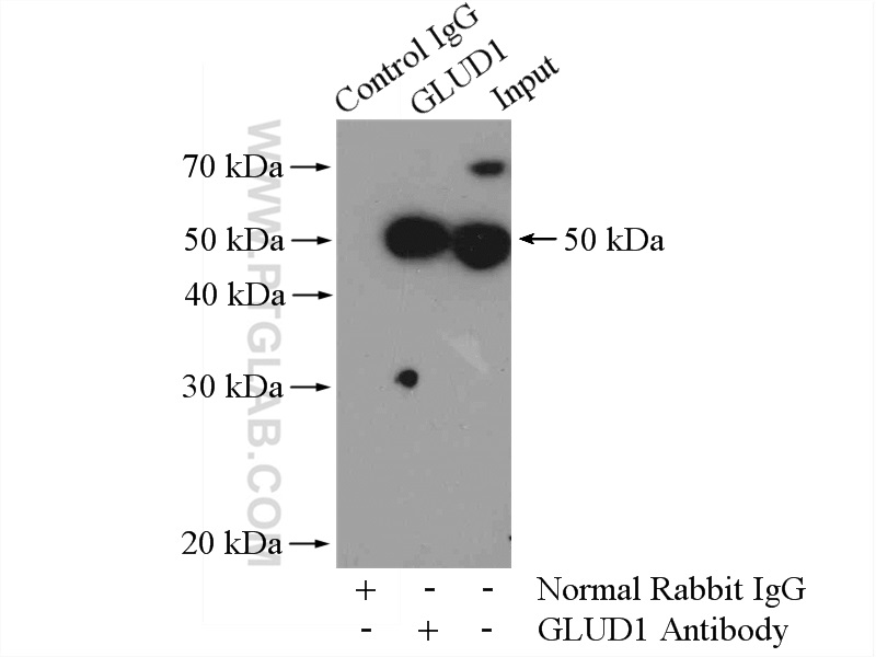 IP experiment of HeLa using 14299-1-AP