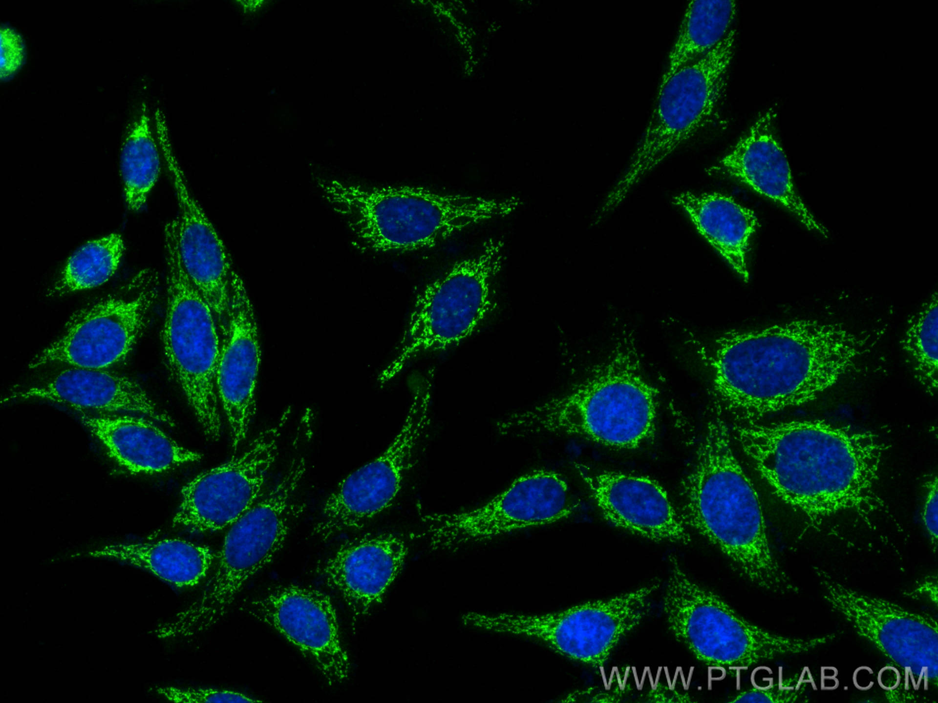 IF Staining of HepG2 using 14462-1-AP