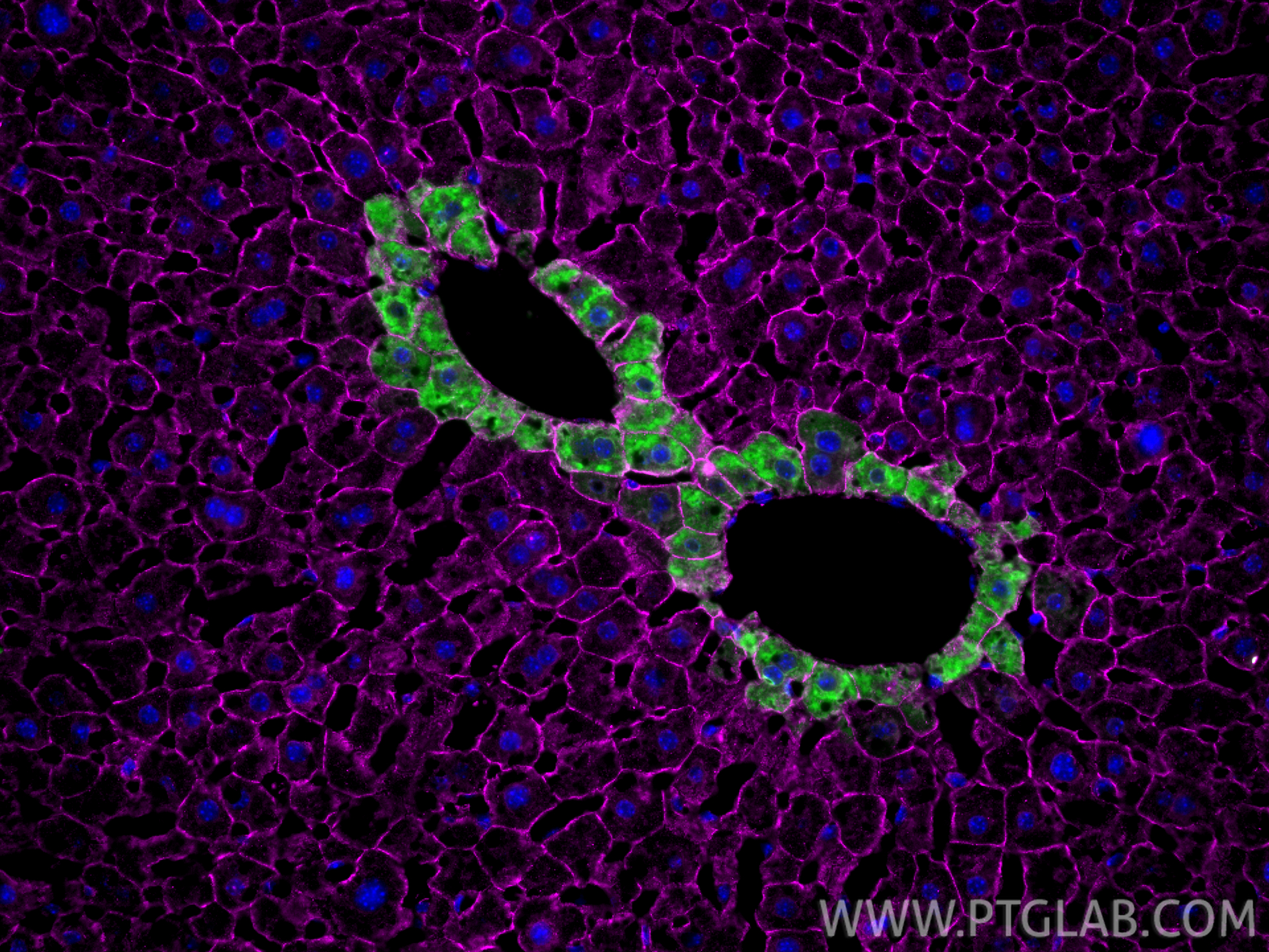 IF Staining of mouse liver using 11037-2-AP IF Staining of mouse liver using 11037-2-AP