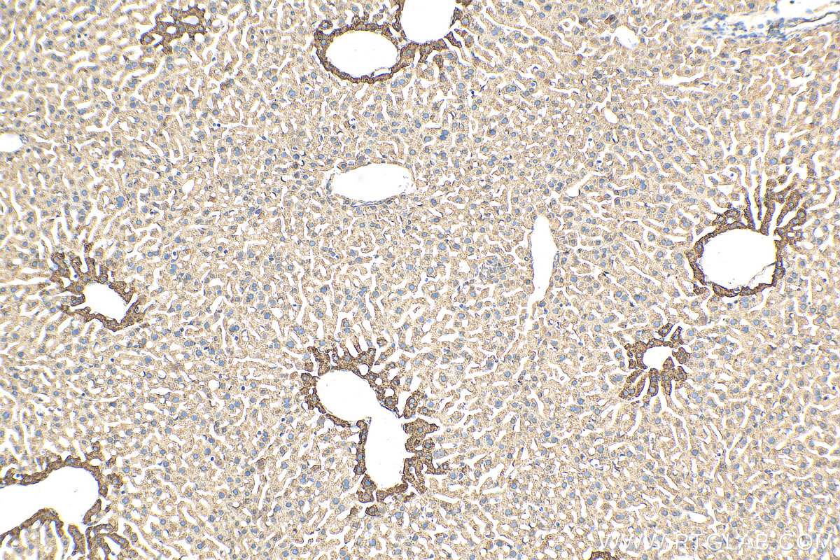 IHC staining of mouse liver using 11037-2-AP