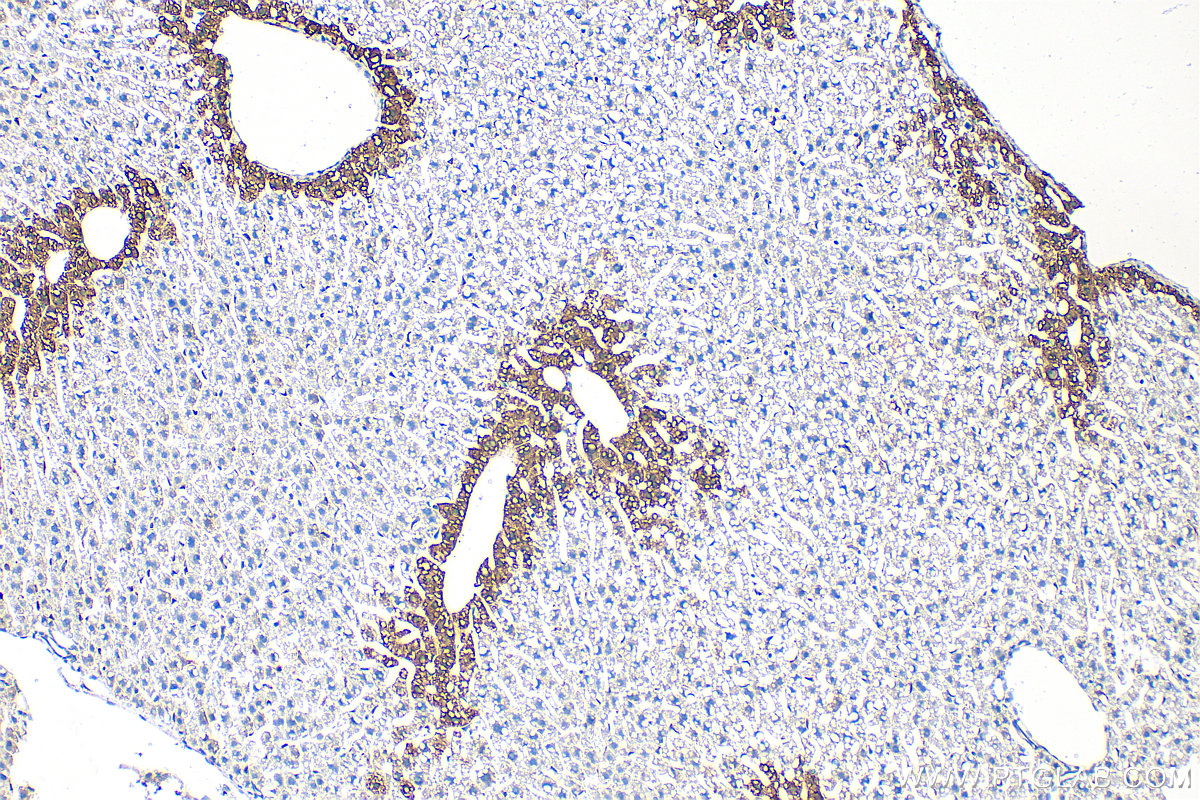 IHC staining of mouse liver using 11037-2-AP