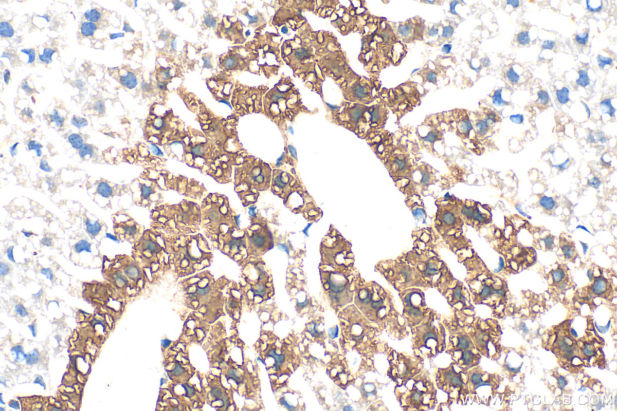 IHC staining of mouse liver using 11037-2-AP