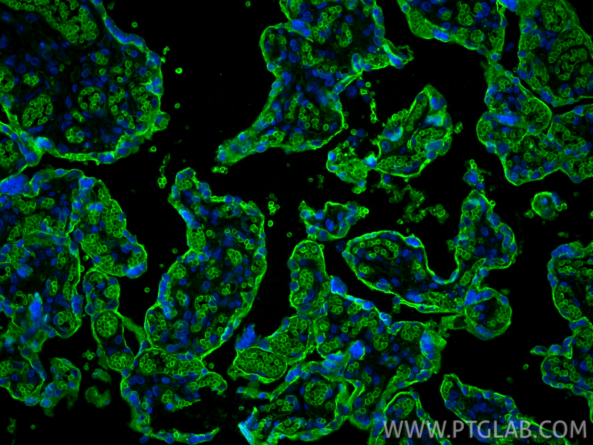 IF Staining of human placenta using 66290-1-Ig