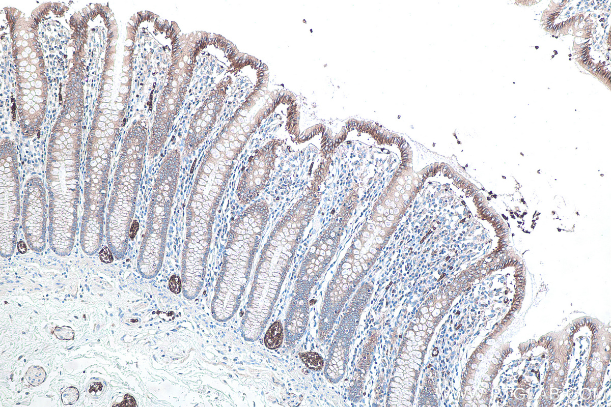IHC staining of human colon using 66290-1-Ig