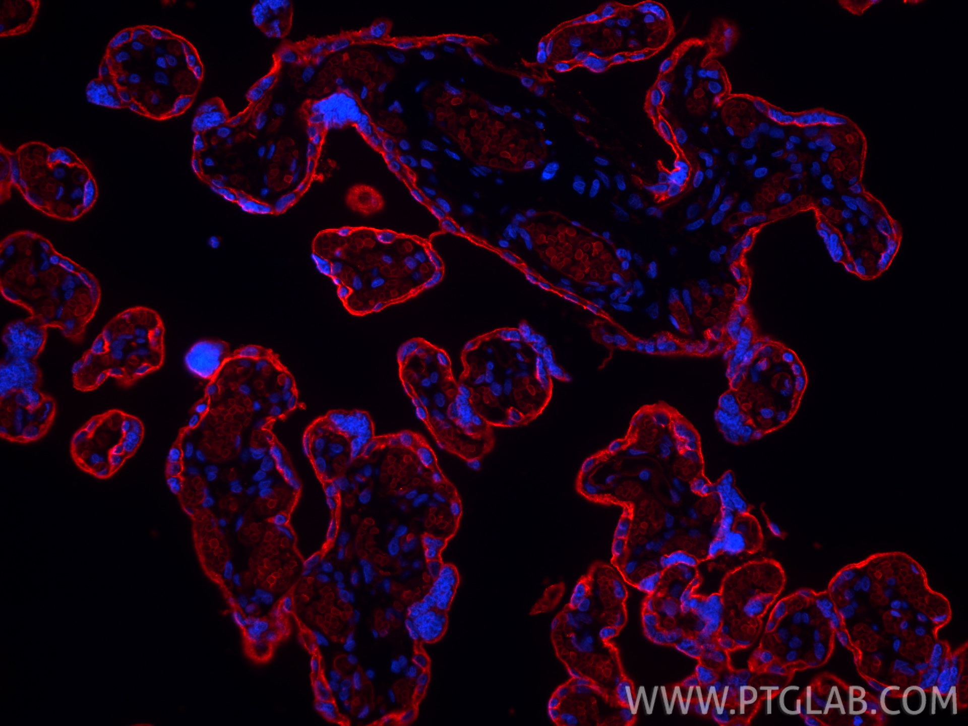 IF Staining of human placenta using CL594-66290 IF Staining of human placenta using CL594-66290