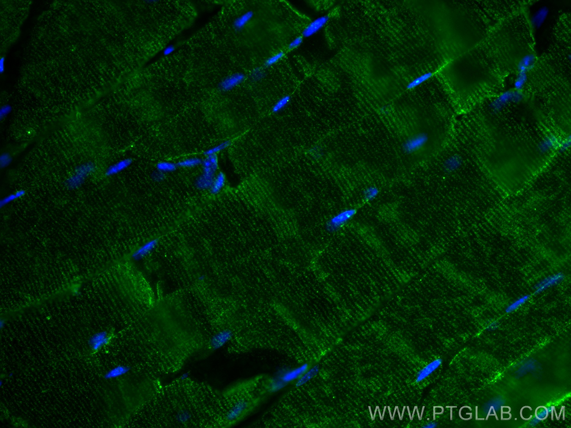 IF Staining of mouse skeletal muscle using 66846-1-Ig