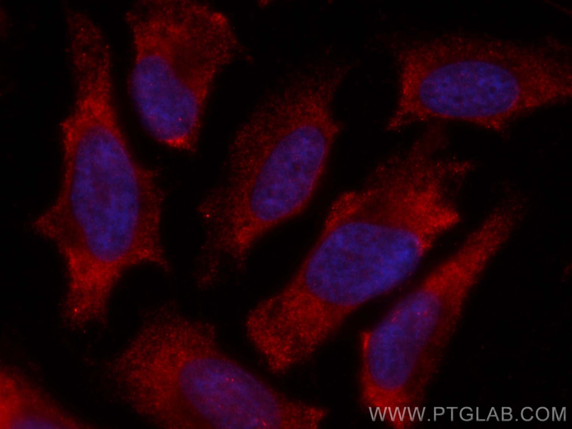 IF Staining of HeLa using CL594-66846