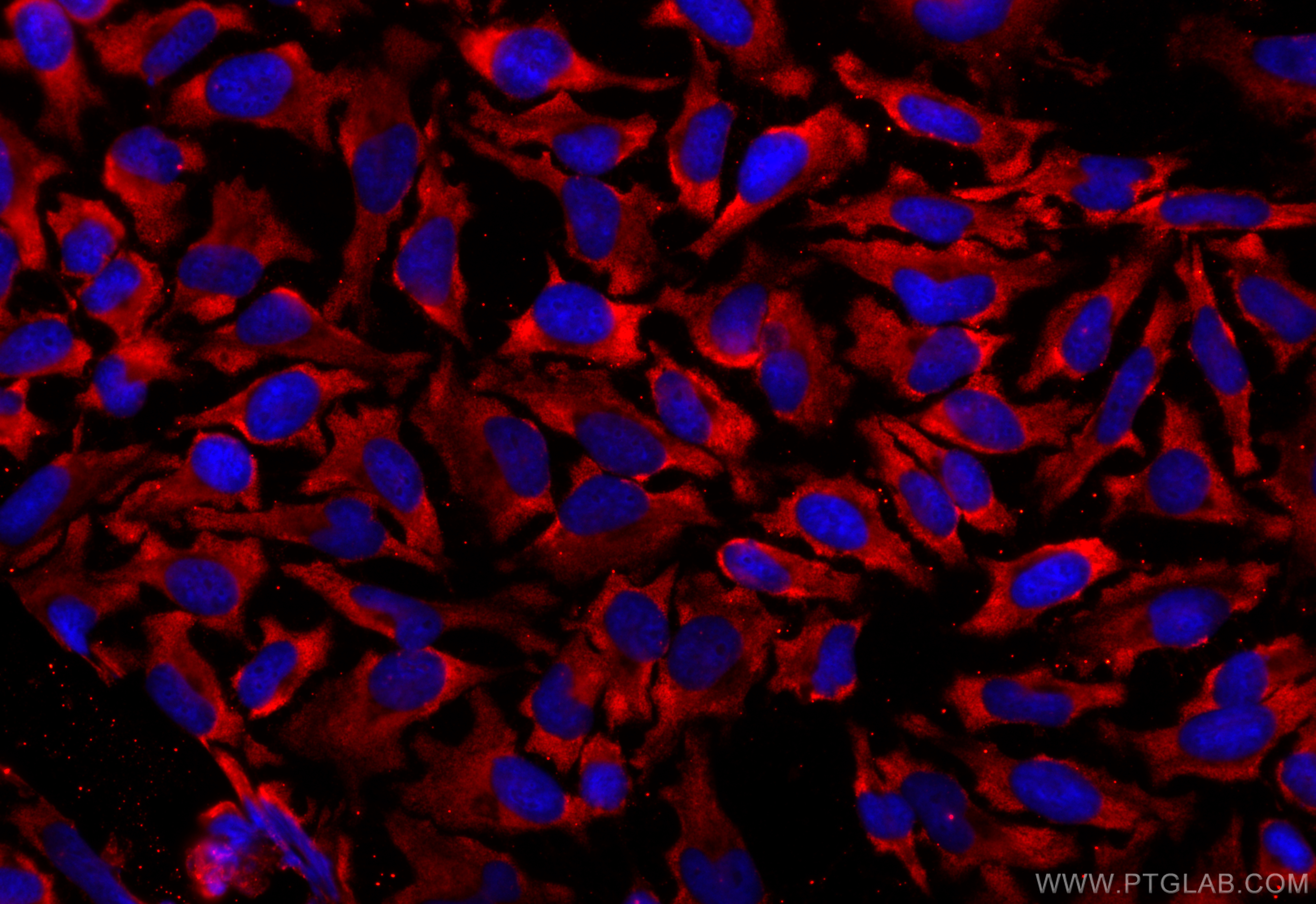 IF Staining of HeLa using CL594-66846