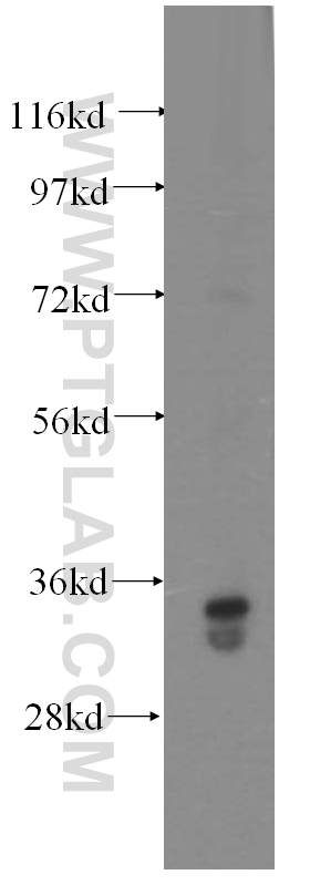 WB analysis of human liver using 15717-1-AP