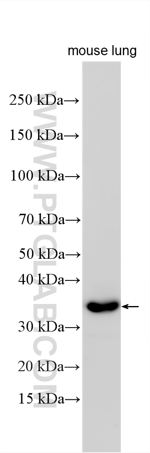 WB analysis using 16305-1-AP