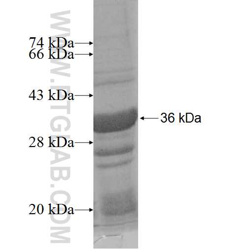 GLYATL2 fusion protein Ag9597 SDS-PAGE GLYATL2 fusion protein Ag9597 SDS-PAGE