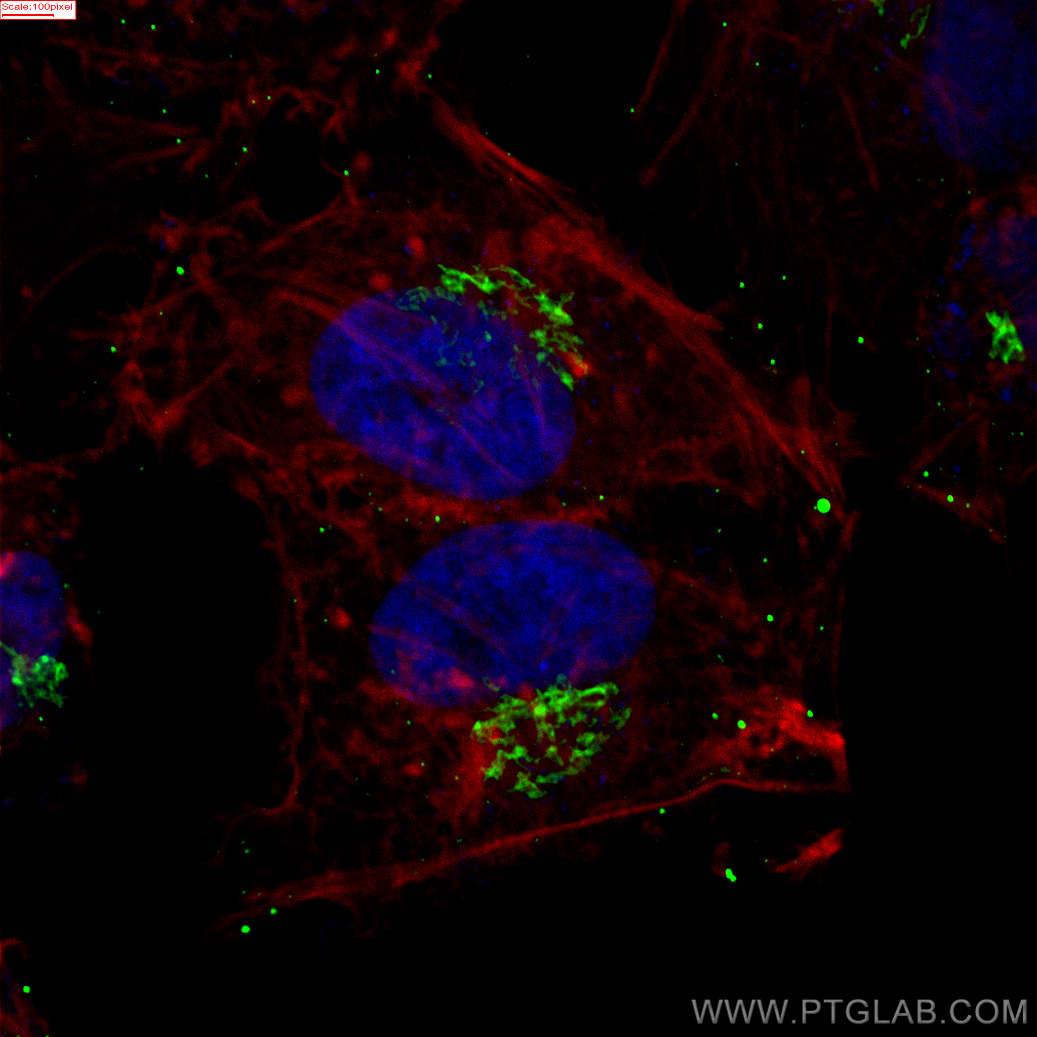 IF Staining of HeLa using 66662-1-Ig (same clone as 66662-1-PBS)
