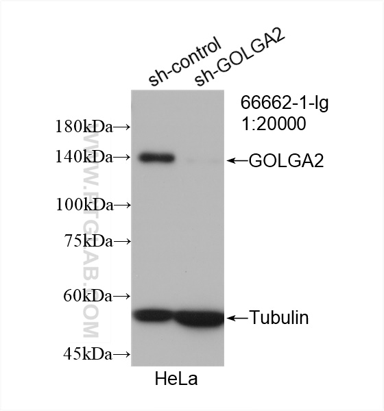 WB analysis of HeLa using 66662-1-Ig (same clone as 66662-1-PBS)