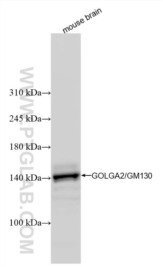 WB analysis using 82705-8-RR WB analysis using 82705-8-RR